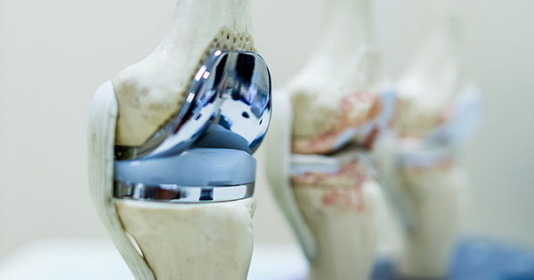 Joint Replacement Surgery in Vijayawada