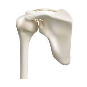 Shoulder Replacement